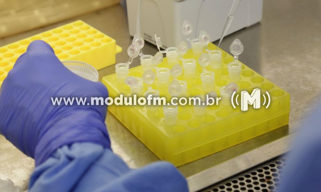 Kits para testes do coronavírus adquiridos pelo município chegam...