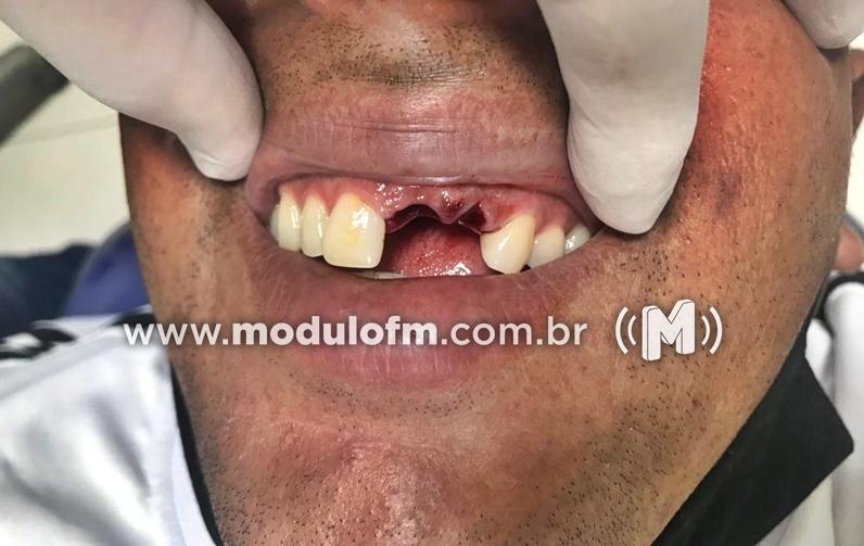 Jogador tem dentes quebrados após tomar cotovelada em lance sem bola na final do Campeonato Máster em Patrocínio