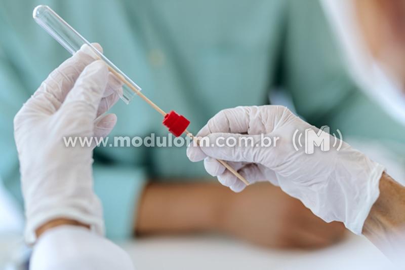 Testes tipo PCR para varíola dos macacos podem ter início na próxima semana